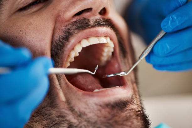 Best Emergency Dental Filling Replacement  in Highland Heights, KY