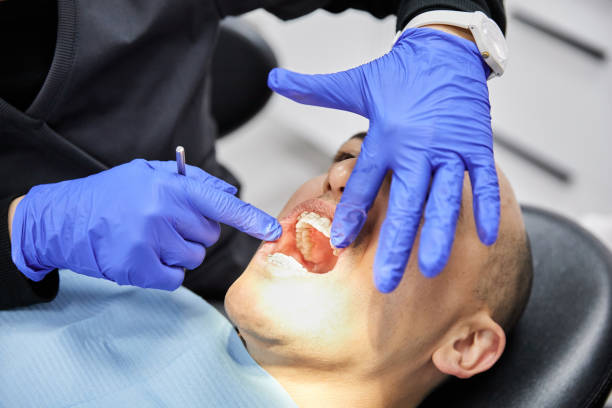 Best Chipped Tooth Repair Near Me  in Highland Heights, KY