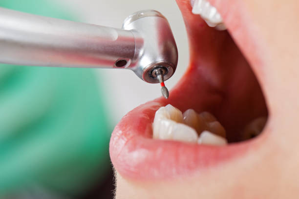 Best Cracked Tooth Emergency Dentist  in Highland Heights, KY